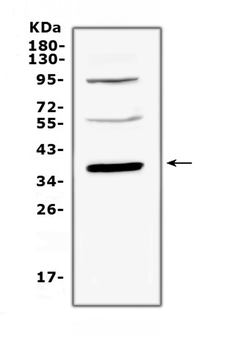 Anti-Thrombopoietin/Thpo Antibody