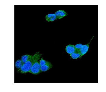 Anti-TIMP4 Antibody