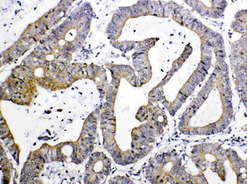 Anti-TIMP4 Antibody