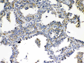 Anti-TIMP4 Antibody