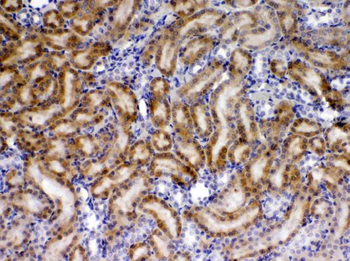 Anti-TIMP4 Antibody
