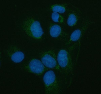 Anti-Pancreatic Lipase/PNLIP Antibody