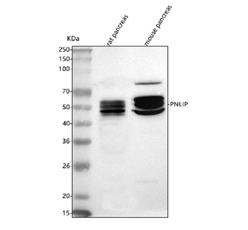 Anti-Pancreatic Lipase/PNLIP Antibody