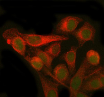 Anti-PMM2 Antibody