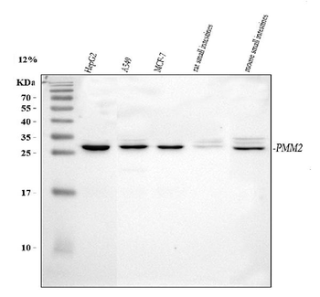 Anti-PMM2 Antibody