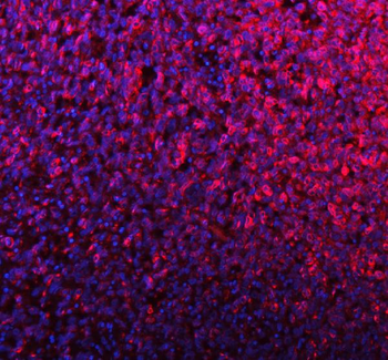 Anti-SILV/PMEL Antibody