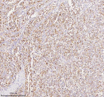 Anti-SILV/PMEL Antibody