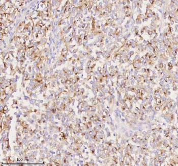 Anti-SILV/PMEL Antibody