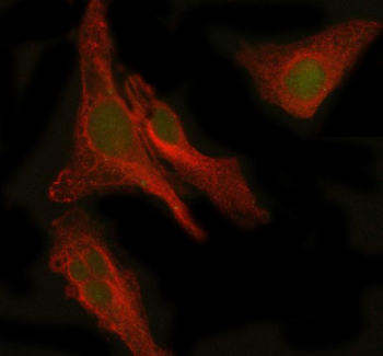 Anti-PEPD Antibody