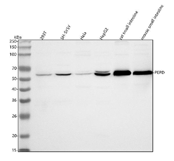 Anti-PEPD Antibody