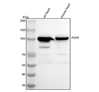 Anti-PDPR Antibody