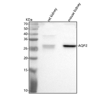 Anti-Aqp2 Antibody