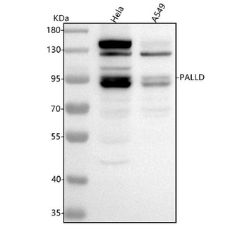 Palladin/PALLD Rabbit Polyclonal Antibody