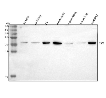 Osm Rabbit Polyclonal Antibody