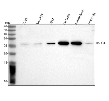 Anti-RSPO4 Antibody