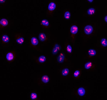 Anti-RSL24D1 Antibody