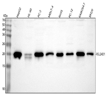 Anti-RSL24D1 Antibody