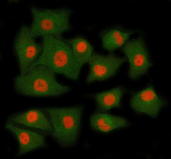 Anti-RING1 Antibody