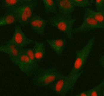 Anti-ORC2 Antibody