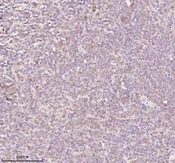 Anti-ORC2 Antibody