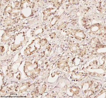 Anti-ORC2 Antibody