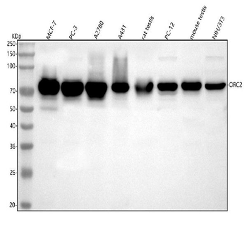 Anti-ORC2 Antibody