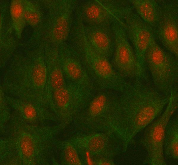 Anti-MAZ Antibody