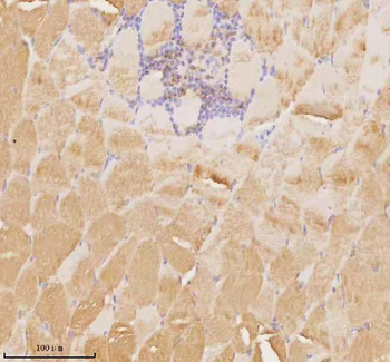 Anti-MAP4K3 Antibody