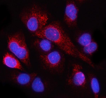 Anti-NUP98 Antibody