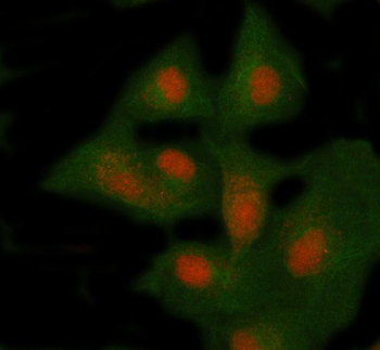 Anti-NSMCE4A Antibody