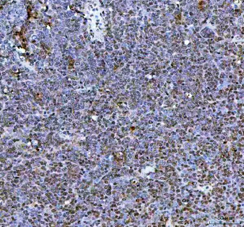 Anti-NR1D2 Antibody