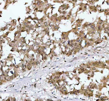 Anti-NR1D2 Antibody