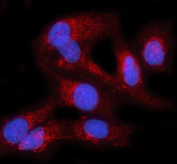 Anti-PRAG1 Antibody