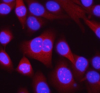 Anti-RPL14 Antibody