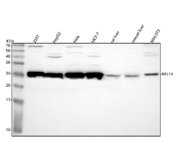 Anti-RPL14 Antibody
