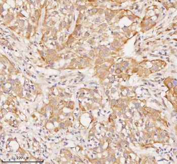 Anti-RNF25 Antibody