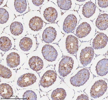 Anti-RNF25 Antibody
