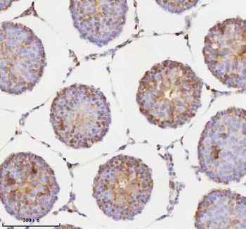 Anti-RNF25 Antibody
