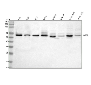 Anti-RNF25 Antibody