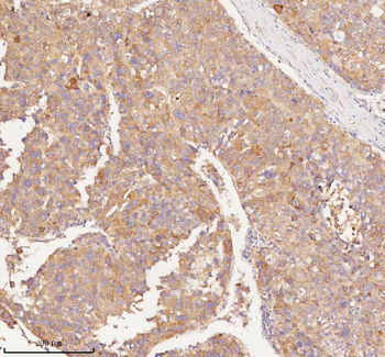 Anti-RNF25 Antibody