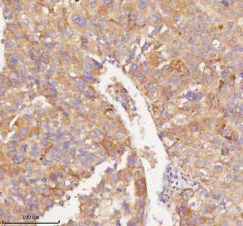 Anti-RNF25 Antibody