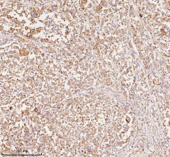 Anti-RNF25 Antibody