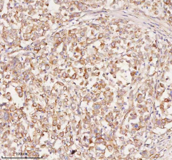 Anti-RNF25 Antibody