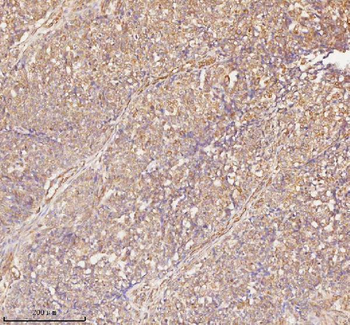 Anti-RNF25 Antibody