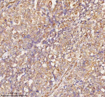 Anti-RNF25 Antibody
