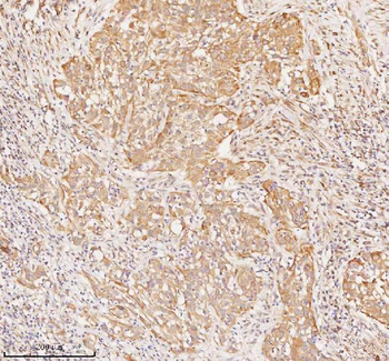 Anti-RNF25 Antibody