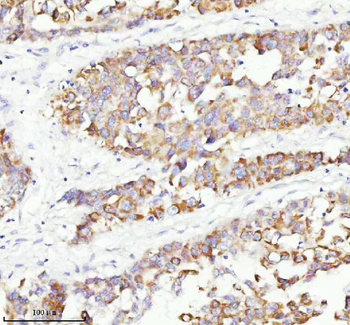 Anti-RGL3 Antibody