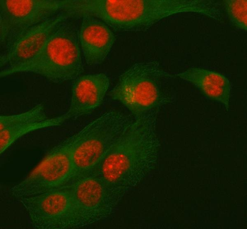 Anti-RBM42 Antibody