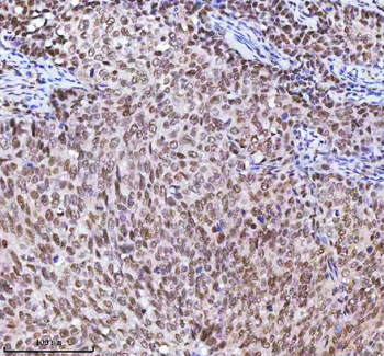 Anti-RBM42 Antibody