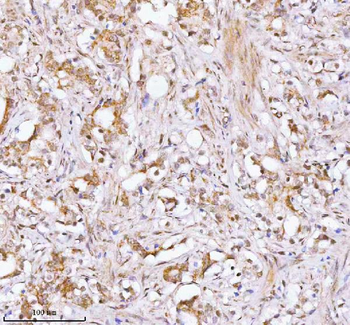 Anti-RBM42 Antibody